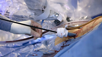 Hjelpende hånd: Operajsonssykepleieren fører inn tråden som «Da Vinci»-maskinen skal sy sammen urinblæra og urinrøret med.